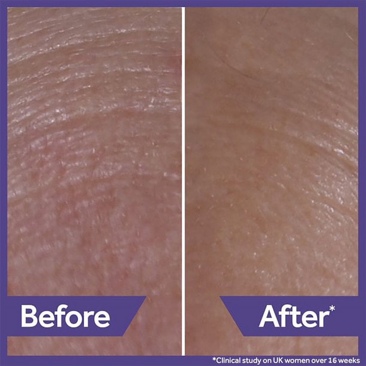 No7 Pure Retinol 1% Night Concentrate Face Cream with Collagen Peptide Technology, 1 fl oz
